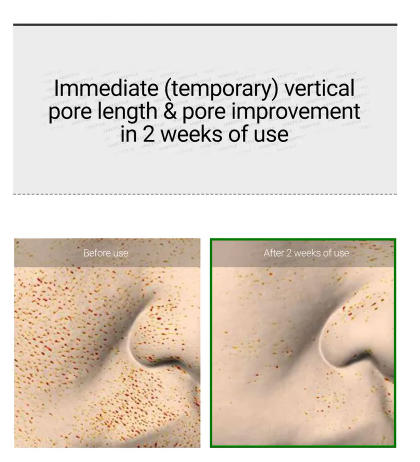 [VT Cosmetics] Reedle Shot 100 - 95,000 Cica Reedles™ for Skin Texture Refinement & Absorption Boosting (50ml / 1.69 fl. oz.)